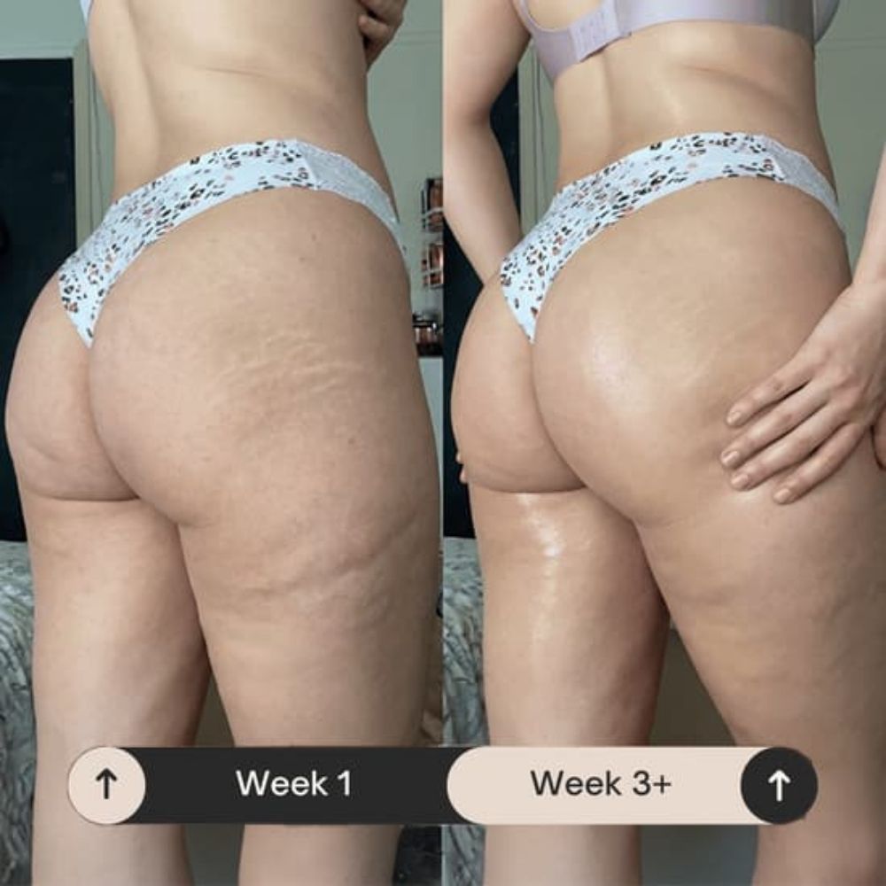 Cellova Anti-Cellulite Massage Oil