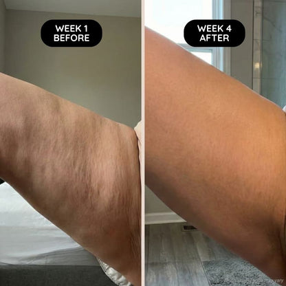 Cellova Anti-Cellulite Massage Oil