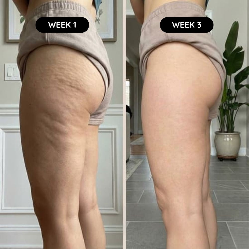 Cellova Anti-Cellulite Massage Oil